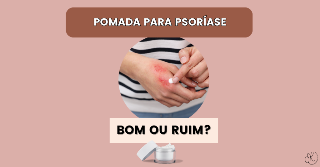 Mão com lesões de psoríase sendo tratada com pomada, ao lado de um pote de creme