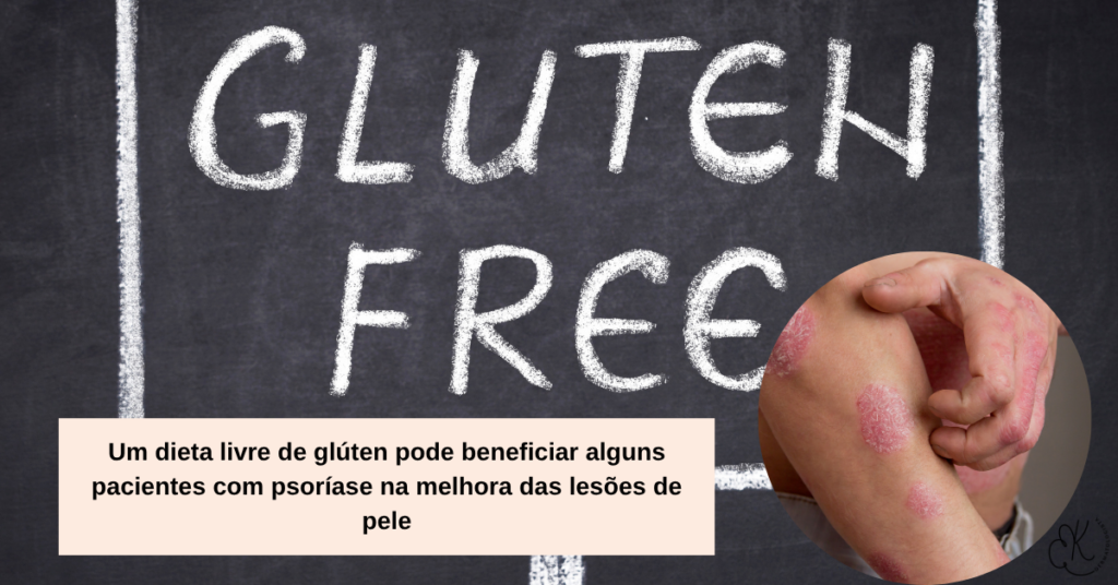 Imagem com pão riscado e lesões de psoríase no braço, com título sobre glúten e psoríase