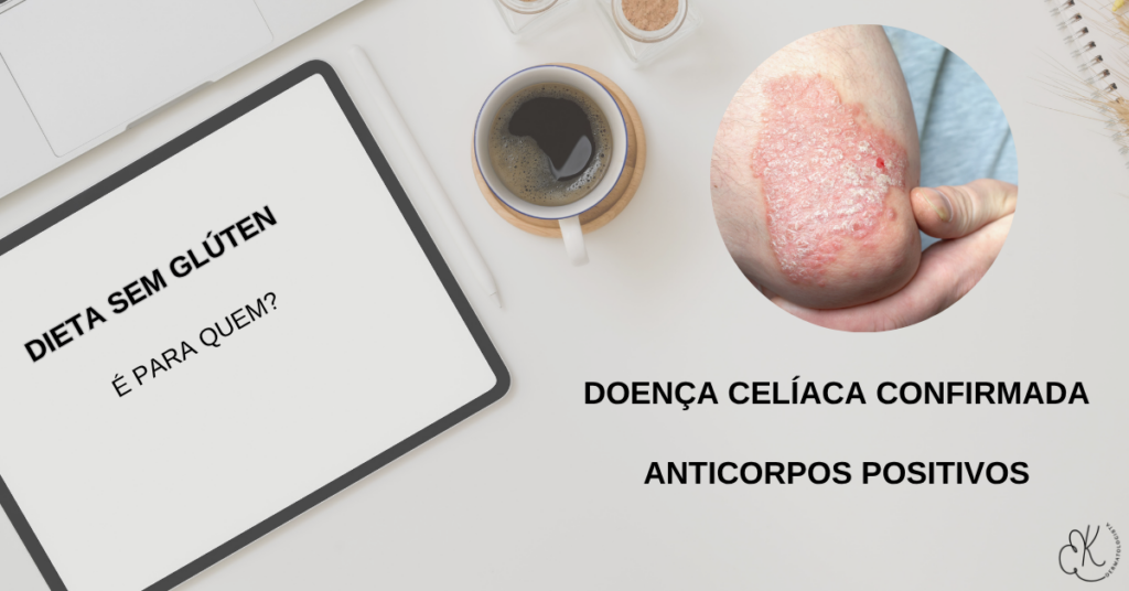 Mesa com café, tablet e imagem de pele com psoríase, indicando dieta sem glúten para casos específicos