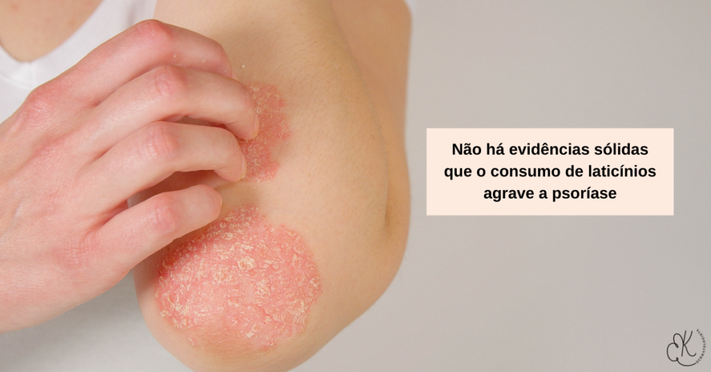 Lesão de psoríase no cotovelo com texto informando que não há evidências sólidas de que laticínios agravem a psoríase