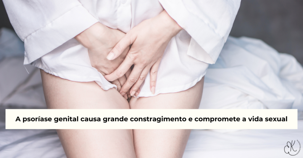 Mulher sentada segurando a região íntima representando psoríase genital e o impacto da doença na vida sexual