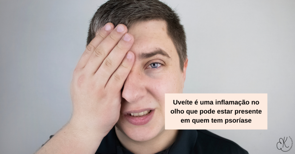 Pessoa cobrindo um olho representando inflamação ocular chamada uveíte