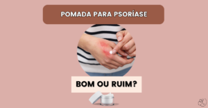 Mão com lesões de psoríase sendo tratada com pomada, ao lado de um pote de creme