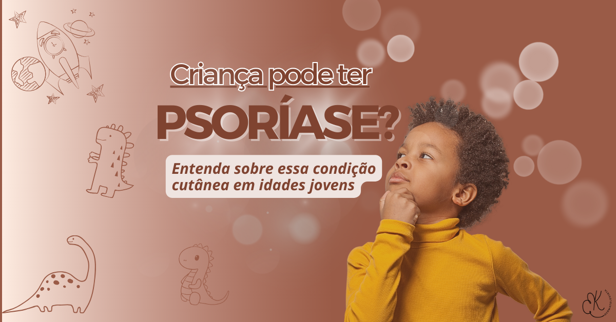 Psoríase em Crianças: Sintomas, Causas e Tratamento | Guia Completo