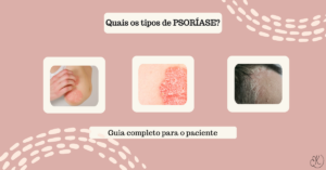 Ilustração com três tipos diferentes de lesões de psoríase