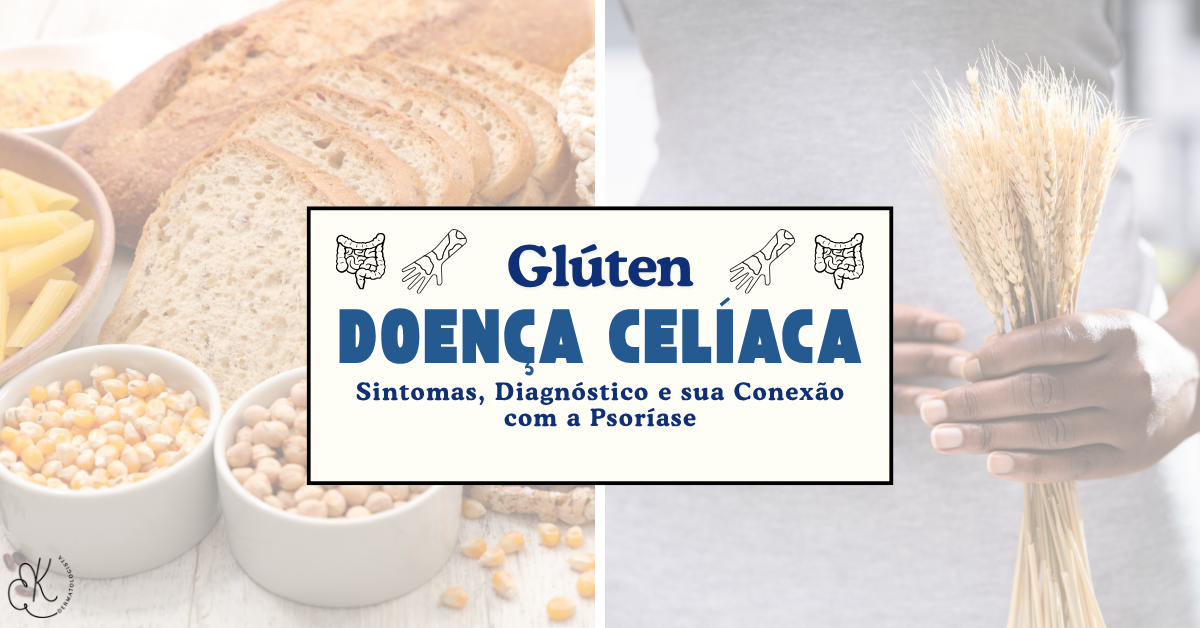 Banner com pães à esquerda, pessoa segurando espigas à direita e título “Glúten — Doença Celíaca: sintomas, diagnóstico e sua conexão com a psoríase”.