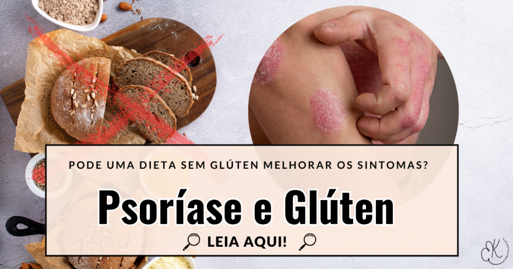 Quadro escrito “gluten free” com imagem de lesões de psoríase no braço
