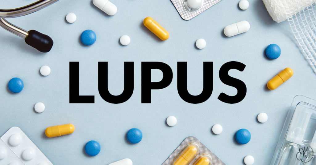 Blocos com a palavra “Lupus” sobre mesa médica, representando o lúpus eritematoso sistêmico como doença autoimune associada à psoríase.