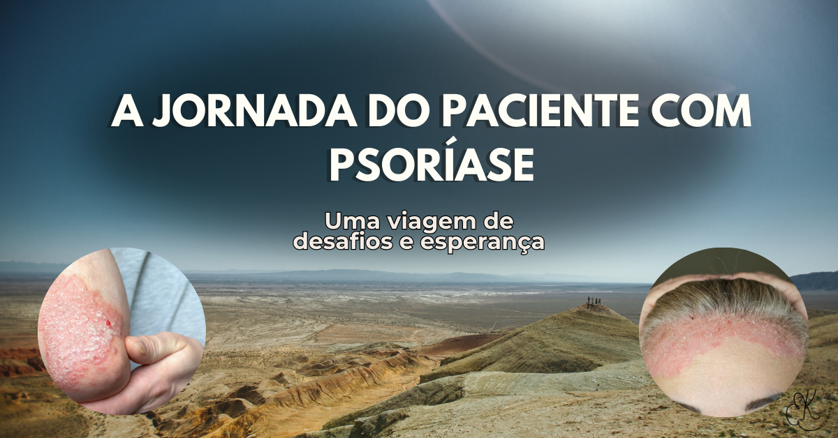 Ilustração representando a jornada do paciente com psoríase, mostrando lesões na pele e o caminho até o diagnóstico e tratamento da doença.
