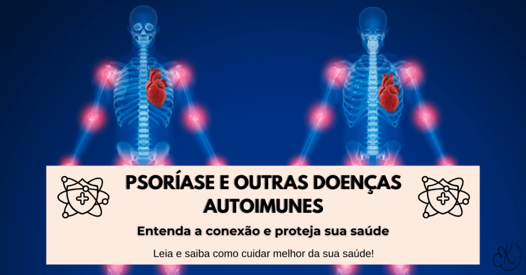 Ilustração do corpo humano com áreas inflamatórias destacadas, representando a psoríase e sua relação com outras doenças autoimunes.