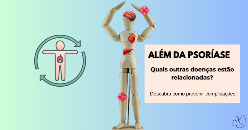 Ilustração de corpo humano destacando órgãos e articulações afetados por doenças associadas à psoríase