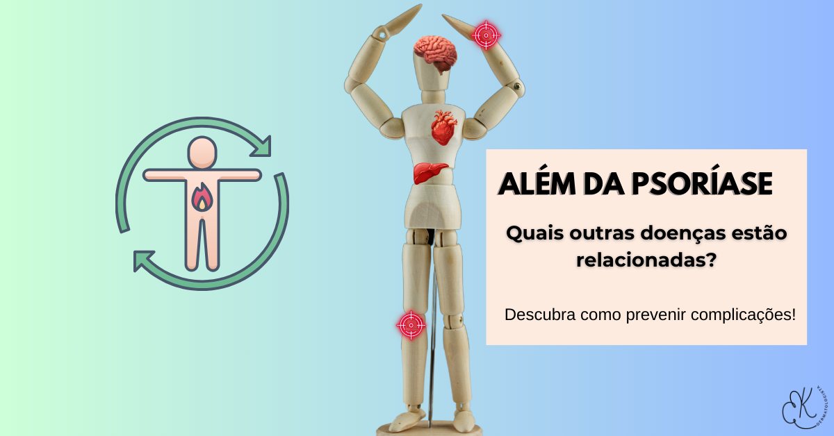 Ilustração de corpo humano destacando órgãos e articulações afetados por doenças associadas à psoríase