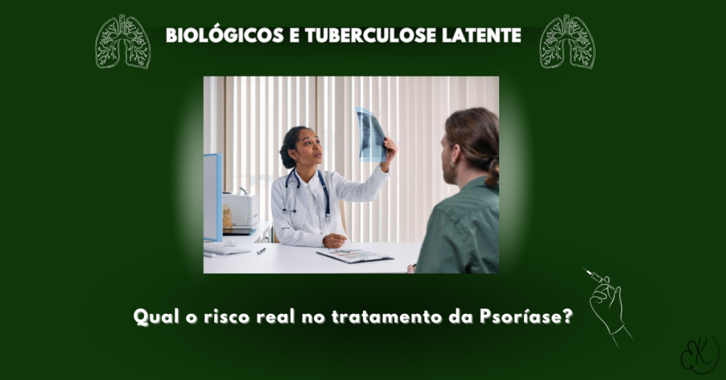 Biológicos e tuberculose latente no tratamento da psoríase